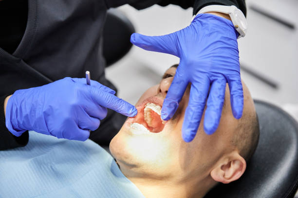 Best Urgent Care for Lost Fillings or Crowns in Forest Park, OH